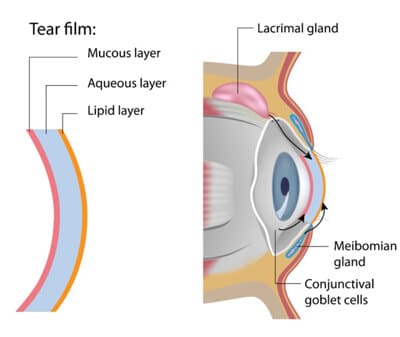 Chart Illustrating How Dry Eye Affects an Eye